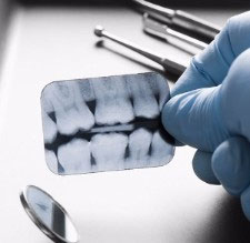 Complimentary Consultation, Langley Orthodontics