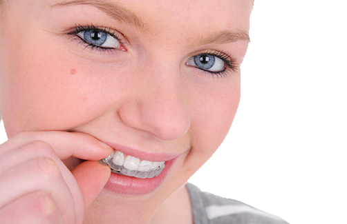 Invisalign for Teens Clear Braces in Langley, Dentist Langley