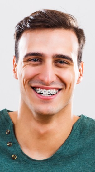 A smiling man wearing braces for adults