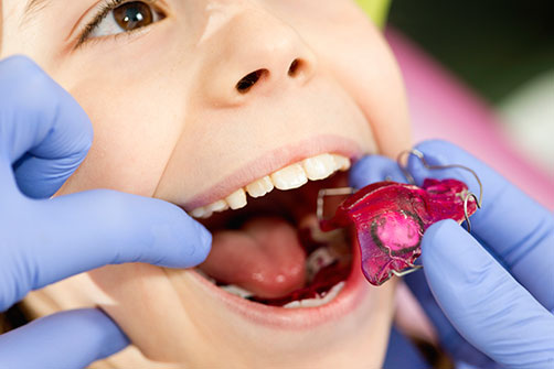 Orthodontic Treatment for Children in Langley