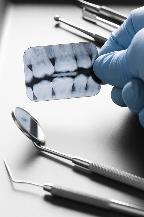 Smile Consultation, Langley Orthodontics, BC
