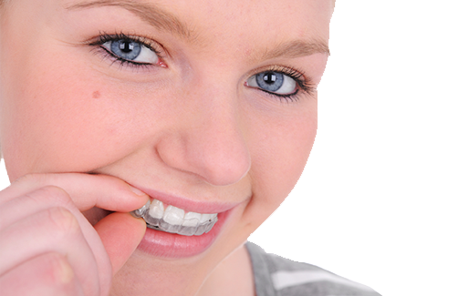 Teen wears Invisalign for Teens in Langley