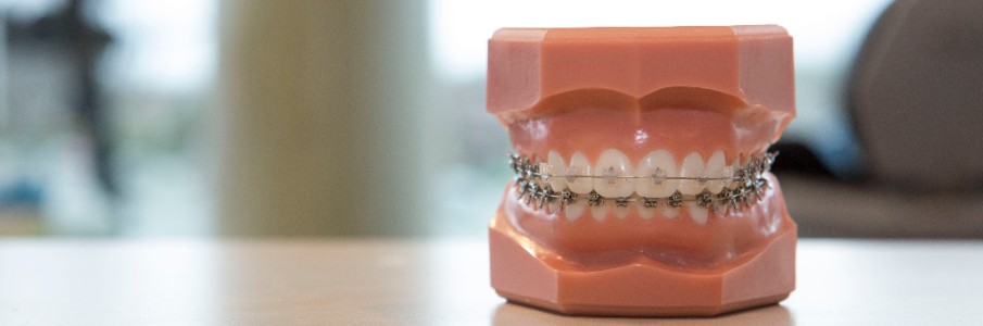 Orthodontic Model