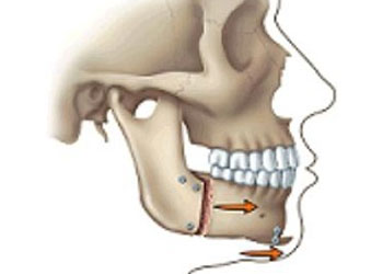 FAQS, Orthodontics & Braces, Langley