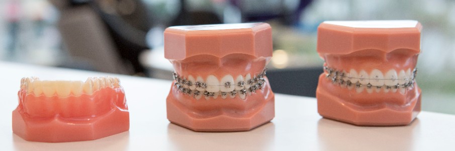 Langley Orthodontics, Braces Process