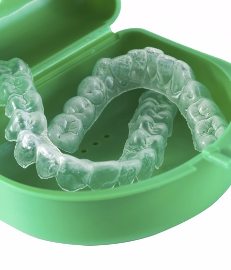 Sports Mouth Guard for Braces, Langley Orthodontics